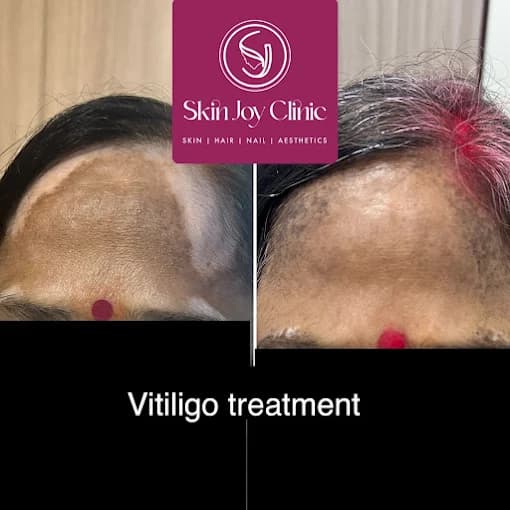 Dermatology Treatment Result