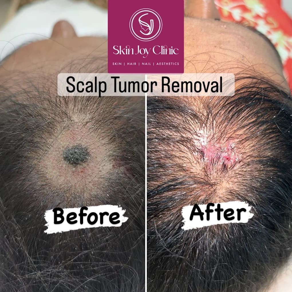 Dermatology Treatment Result