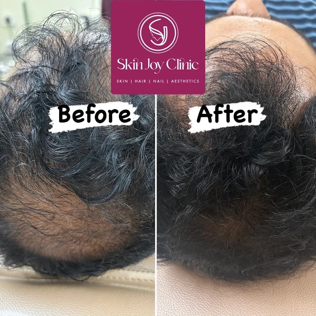 Dermatology Treatment Result