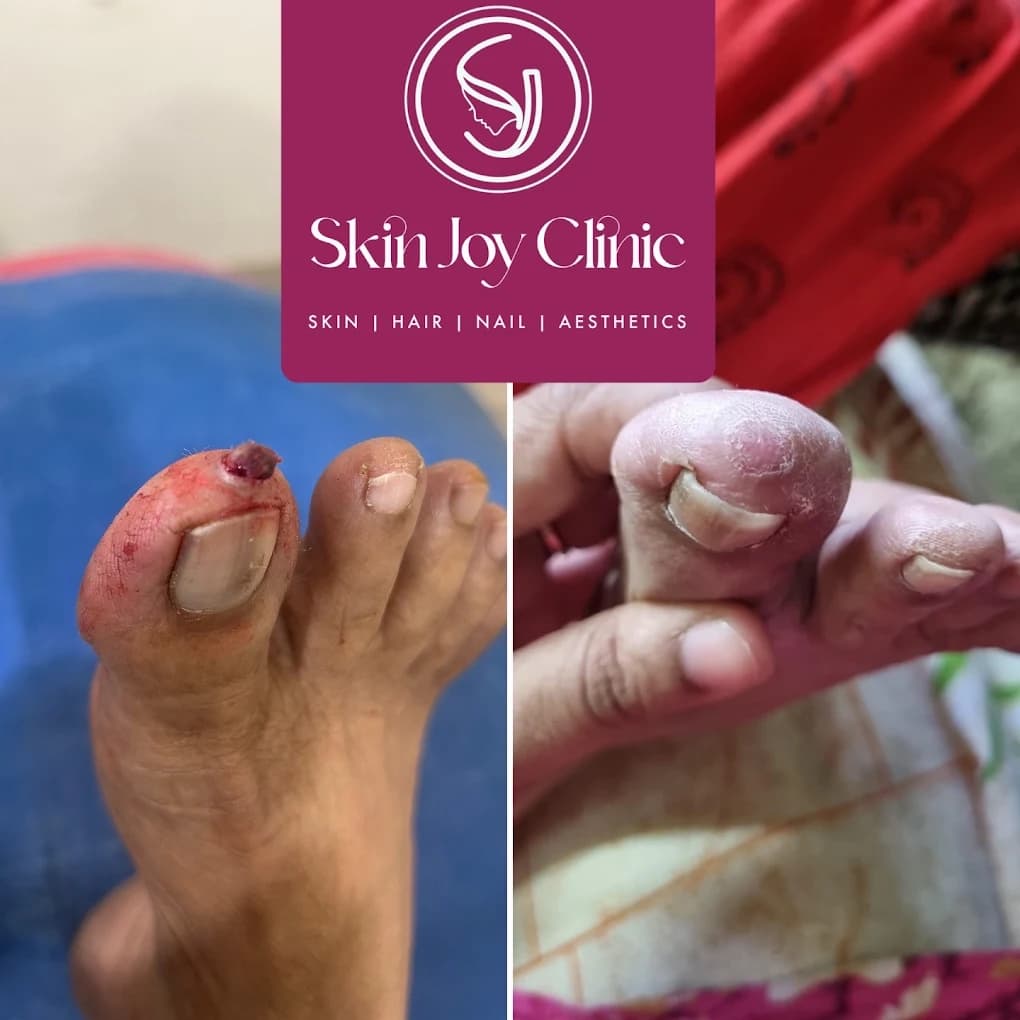 Dermatology Treatment Result
