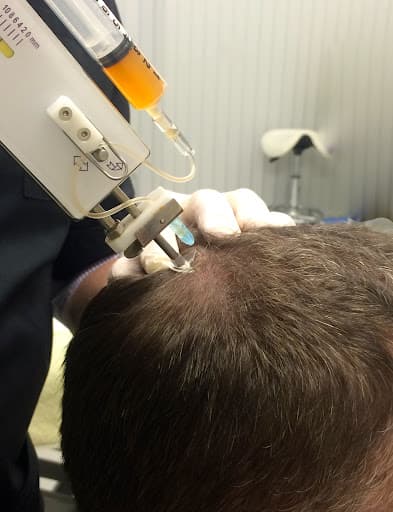 PRP Therapy