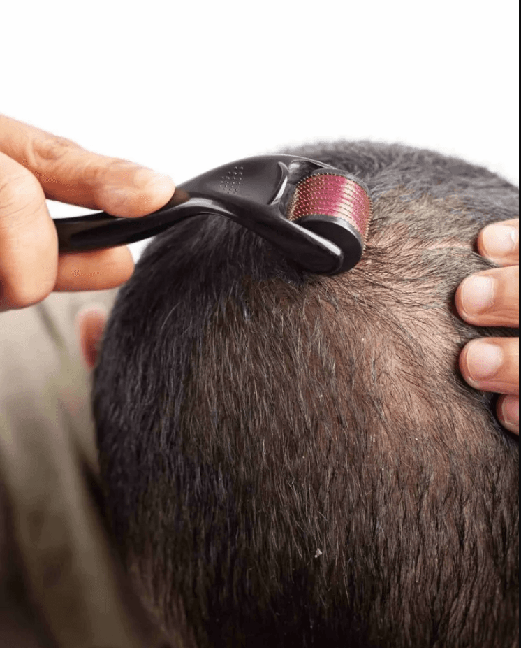 Mesotherapy